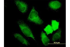 Immunofluorescence of monoclonal antibody to NRBP1 on HeLa cell. (NRBP1 抗体  (AA 436-535))