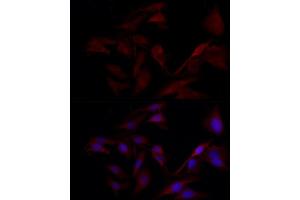 Immunofluorescence analysis of U2OS cells using TYK2 Rabbit pAb (ABIN3022987, ABIN3022988, ABIN3022989 and ABIN6219333) at dilution of 1:150 (40x lens). (TYK2 抗体  (AA 750-850))