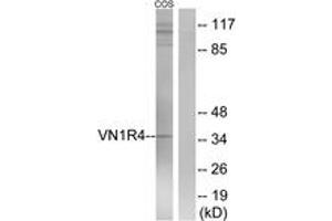 Western blot analysis of extracts from COS7 cells, using VN1R4 Antibody.