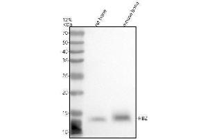 Western blot analysis of HBZ using anti-HBZ antibody (ABIN7601827).