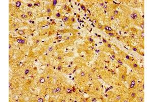Immunohistochemistry of paraffin-embedded human liver tissue using ABIN7163666 at dilution of 1: 100 (PHLDA1 抗体  (AA 1-138))