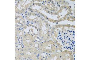 Immunohistochemistry of paraffin-embedded mouse kidney using CHMP1B antibody at dilution of 1:100 (x40 lens). (CHMP1B 抗体)