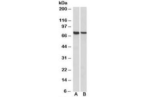 Western blot testing of mouse [A] and rat [B] spleen lysates with MUNC18-3 antibody at 1ug/ml. (STXBP3 抗体)