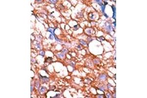Image no. 2 for anti-V-Erb-A erythroblastic Leukemia Viral Oncogene Homolog 4 (Avian) (ERBB4) (pTyr1162) antibody (ABIN358139) (ERBB4 抗体  (pTyr1162))