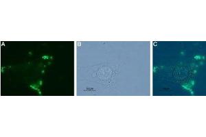 Expression of NTSR1 in human MCF-7 cells - Cell surface detection of NTSR1 in live intact human MCF-7 breast adenocarcinoma cell line.