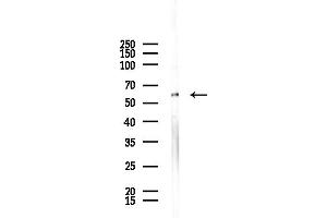 Western blot analysis of lysates from HepG2 cells(starvation,24h treatment), using TRIM16 Antibody at 1/1000 dilution.