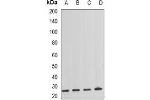 Western blot analysis of NAT8 expression in HEK293T (A), mouse spleen (B), mouse lung (C), rat kidney (D) whole cell lysates. (NAT8 抗体)