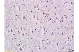 Formalin-fixed and paraffin embedded rat brain tissue labeled with Rabbit Anti-GABRA1 Polyclonal Antibody, Unconjugated (ABIN703796) at 1:200 followed by conjugation to the secondary antibody and DAB staining (GABRA1 抗体  (AA 351-456))