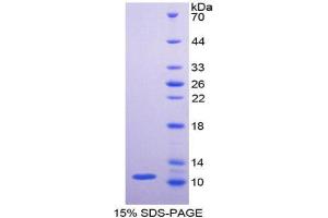 SDS-PAGE analysis of Human PKM2 Protein. (PKM 蛋白)