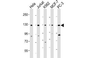 All lanes : Anti-RFX1 Antibody (C-term) at 1:2000 dilution Lane 1: Hela whole cell lysate Lane 2: Jurkat whole cell lysate Lane 3: K562 whole cell lysate Lane 4: MCF-7 whole cell lysate Lane 5: PC-3 whole cell lysate Lysates/proteins at 20 μg per lane. (RFX1 抗体  (C-Term))