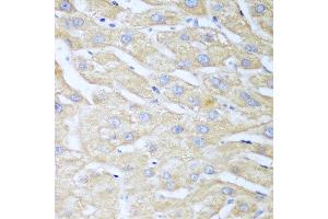 Immunohistochemistry of paraffin-embedded human liver using NUDT15 antibody at dilution of 1:100 (40x lens). (NUDT15 抗体)