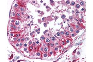 Anti-PTRH2 antibody IHC of human testis. (PTRH2 抗体  (N-Term))