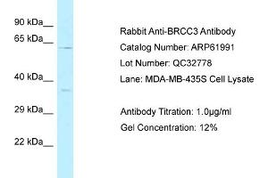 Western Blotting (WB) image for anti-BRCA1/BRCA2-Containing Complex, Subunit 3 (BRCC3) (C-Term) antibody (ABIN2788977) (BRCC3 抗体  (C-Term))