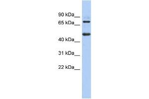 WB Suggested Anti-ZBTB26 Antibody Titration:  0. (ZBTB26 抗体  (N-Term))