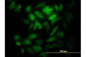 Immunofluorescence of monoclonal antibody to KNTC1 on HeLa cell. (KNTC1 抗体  (AA 2100-2209))