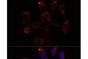 Immunofluorescence analysis of NIH/3T3 cells using YTHDC2 Polyclonal Antibody at dilution of 1:100. (YTHDC2 抗体)