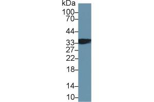 Detection of TNNT1 in Mouse Skeletal muscle lysate using Polyclonal Antibody to Troponin T Type 1, Slow Skeletal (TNNT1) (TNNT1 抗体  (AA 1-259))