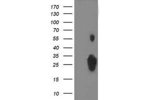 Western Blotting (WB) image for anti-Chromosome 1 Open Reading Frame 50 (C1ORF50) antibody (ABIN1497034) (C1ORF50 抗体)