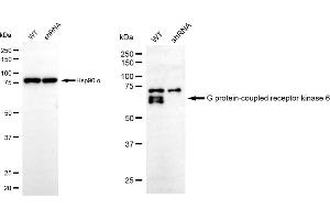 Western blotting analysis using G protein-coupled receptor kinase 6 antibody (ABIN7798675). (Recombinant GRK6 抗体)