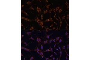 Immunofluorescence analysis of C6 cells using UBE2J1 antibody (ABIN7271172) at dilution of 1:100. (UBE2J1 抗体  (AA 1-100))