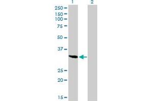 Western Blot analysis of SPARC expression in transfected 293T cell line by SPARC monoclonal antibody (M02A), clone 1B2. (SPARC 抗体  (AA 1-303))