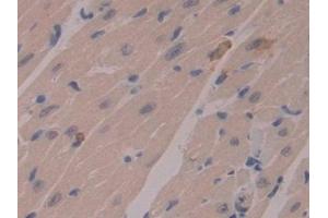 Detection of MMP7 in Mouse Heart Tissue using Polyclonal Antibody to Matrix Metalloproteinase 7 (MMP7) (MMP7 抗体  (AA 1-264))