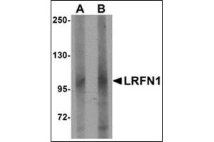 Western blot analysis of LRFN1 in human brain lysate with this product at (A) 1 and (B) 2 μg/ml. (LRFN1 抗体  (C-Term))
