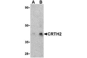 Western blot analysis of CRTH2 in human heart tissue lysate with CRTH2 antibody at (A) 1 and (B) 2 μg/ml. (Prostaglandin D2 Receptor 2 (PTGDR2) (Center) 抗体)