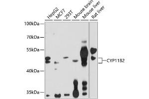 Western blot analysis of extracts of various cell lines, using CYP11B2 antibody (ABIN1679468, ABIN3015492, ABIN3015493 and ABIN6218533) at 1:1000 dilution. (CYP11B2 抗体  (AA 234-503))
