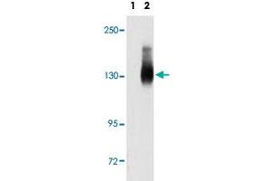 Western blot analysis of JAG2 (arrow) using JAG2 polyclonal antibody . (JAG2 抗体  (C-Term))