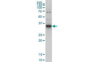 Western Blotting (WB) image for anti-Zic Family Member 4 (ZIC4) (AA 249-320) antibody (ABIN466251) (ZIC4 抗体  (AA 249-320))