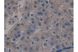 Detection of MBL in Human Liver Tissue using Polyclonal Antibody to Mannose Binding Lectin (MBL) (MBL2 抗体  (AA 130-248))
