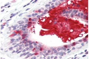 Anti-APRIL antibody IHC staining of human breast. (TNFSF13 抗体  (Internal Region))