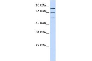 WB Suggested Anti-ZNF699 Antibody Titration:  0. (ZNF699 抗体  (N-Term))
