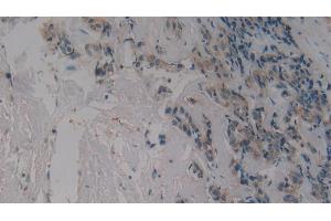 Immunohistochemistry (IHC) image for anti-Glycophorin A (GYPA) (AA 20-91) antibody (ABIN7440662)