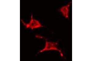 ABIN6266801 staining 293 by IF/ICC. (YTHDF1 抗体  (N-Term))