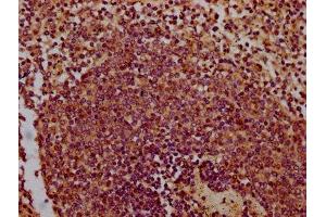 IHC image of ABIN7147649 diluted at 1:300 and staining in paraffin-embedded human spleen tissue performed on a Leica BondTM system. (CHODL 抗体  (AA 105-206))