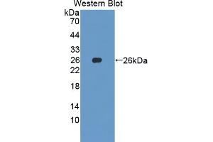 Detection of Recombinant SKP1, Human using Polyclonal Antibody to S-Phase Kinase Associated Protein 1 (SKP1) (SKP1 抗体  (AA 1-163))