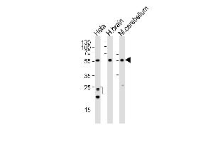 Western blot analysis of lysates from Hela cell line , human brain and mouse cerebellum tissue lysate(from left to right), using PFTK1 Antibody (N-term ) A. (CDK14 抗体  (N-Term))