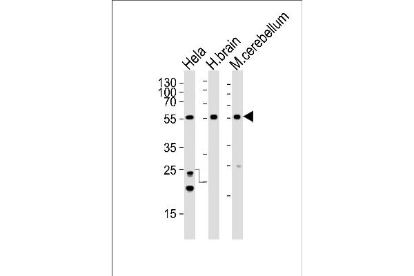 CDK14 抗体  (N-Term)
