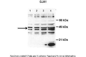 Western Blotting (WB) image for anti-Gap Junction Protein, alpha 1, 43kDa (GJA1) (N-Term) antibody (ABIN2774853)