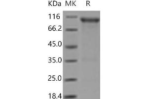 Western Blotting (WB) image for Fibroblast Growth Factor Receptor 4 (FGFR4) (Active) protein (Fc Tag) (ABIN7321218) (FGFR4 Protein (Fc Tag))