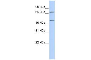 SLC5A7 antibody used at 1 ug/ml to detect target protein. (ChT 抗体)