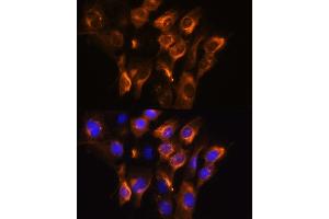Immunofluorescence analysis of C6 cells using  Rabbit pAb (ABIN6134011, ABIN6136599, ABIN6136600 and ABIN6224718) at dilution of 1:100. (ADRB3 抗体  (AA 1-100))