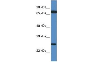 WB Suggested Anti-RPL7A AntibodyTitration: 1. (RPL7A 抗体  (C-Term))