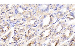 Detection of GCK in Mouse Stomach Tissue using Polyclonal Antibody to Glucokinase (GCK) (GCK 抗体  (AA 3-226))