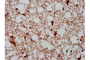 IHC image of ABIN7165027 diluted at 1:400 and staining in paraffin-embedded human brain tissue performed on a Leica BondTM system. (AHNAK2 抗体  (AA 195-349))