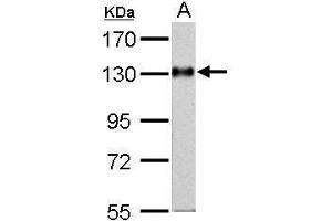 Western Blotting (WB) image for anti-Amphiphysin (AMPH) (N-Term) antibody (ABIN2855590)