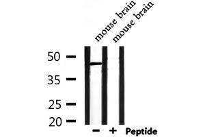 Western blot analysis of extracts from mouse brain, using NPY1R Antibody. (NPY1R 抗体  (Internal Region))