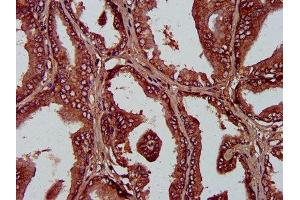 IHC image of ABIN7163316 diluted at 1:400 and staining in paraffin-embedded human prostate tissue performed on a Leica BondTM system. (PLA1A 抗体  (AA 293-398))
